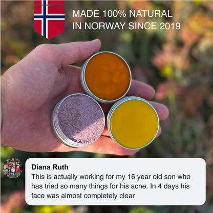 Norse Organics Redness & Breakout Support Ritual